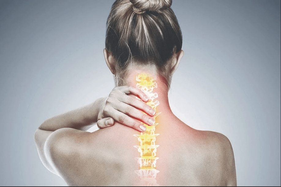 Osteochondroza cervicală