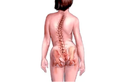 Motivele dezvoltării osteochondrozei cervicale