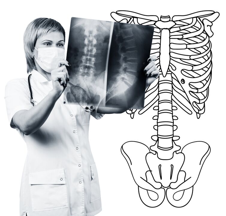 Radiografie a coloanei vertebrale lombare